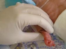 Недоношенные дети