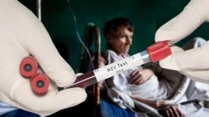 ВИЧ-положительный статус